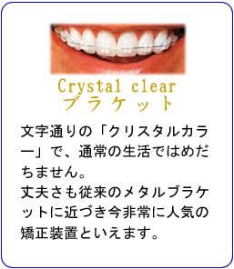 Crystal clear uPbg